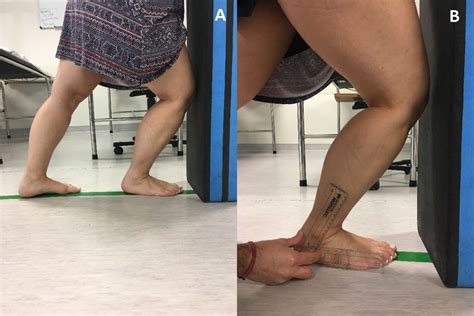 Measurement of the ankle dorsiflexion range of motion in a closed ...