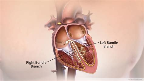 Bundle Branches – Medmovie.com