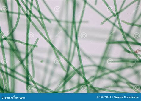 Oscillatoria is a Genus of Filamentous Cyanobacterium, Oscillation in Its Movement Under the ...