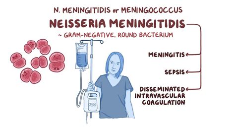 Neisseria meningitidis: Video, Anatomy & Definition | Osmosis