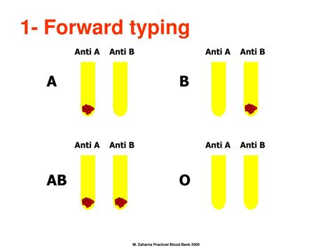 Blood Group Test Tube Method at Sheila Peters blog