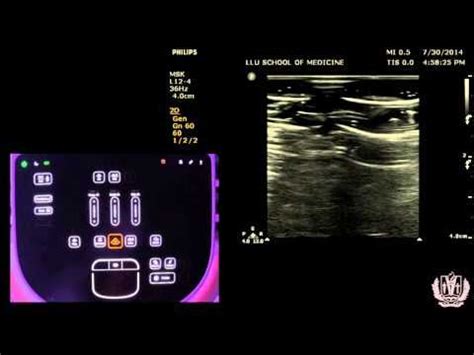 Learn the Basics of Ultrasound Machine Settings. Ultrasound Knbology, Ultrasound Probes ...