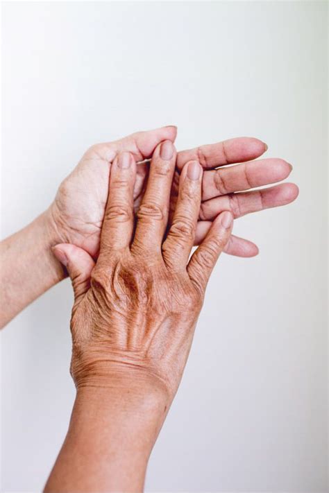 Early Signs of Rheumatoid Arthritis | Hands, Health and Read on