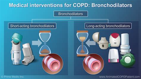 Slide Show - Management and Treatment of COPD