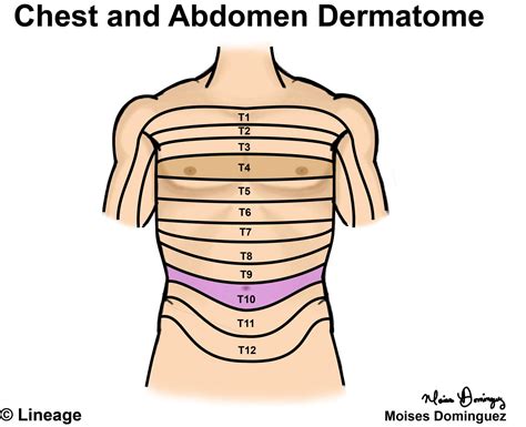 Dermatomes - USMLE Strike