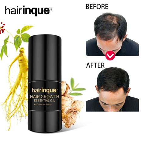 Hairinque 15ml Ginger extract Hair Growth Essence Oil Prevents hair ...