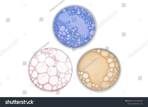 27.868 Microbiology Petri Images, Stock Photos, 3D objects, & Vectors ...