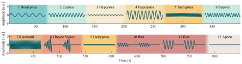 Sensors | Free Full-Text | Breathing Pattern Monitoring by Using Remote ...