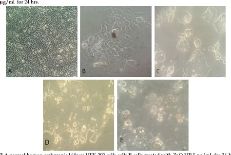 Figure 2 from Clinical applications of ZnO nanoparticles | Semantic Scholar