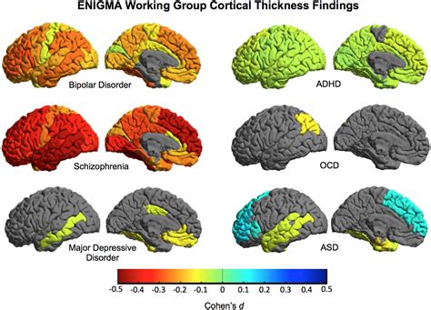 Human Brain Mapping | Neuroimaging Journal | Wiley Online Library