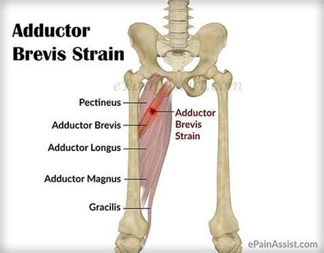 Pictures Of Adductor BrevisHealthiack