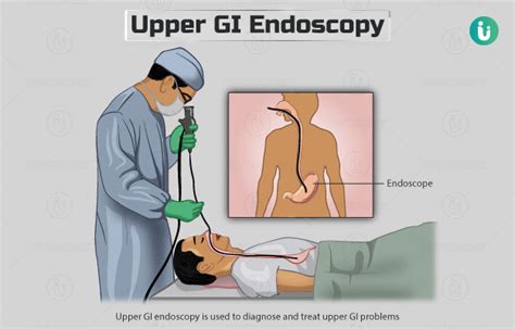 Upper GI Endoscopy: Procedure, Purpose, Results, Cost, Price, Online ...