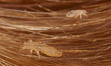 More information on treating head lice than just hair - Gwrra Regiond ...