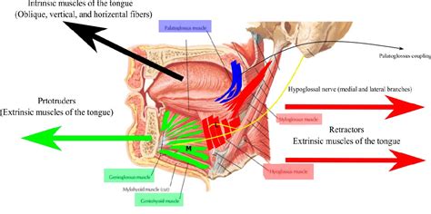 Hypoglossal Nerve Stimulation for Obstructive Sleep Apnea - Machine ...