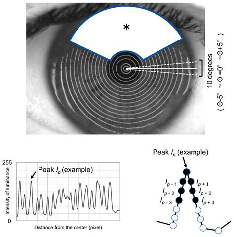 Successful Detection of the Characteristics of Tear Film Breakup Appearing Immediately after Eye ...