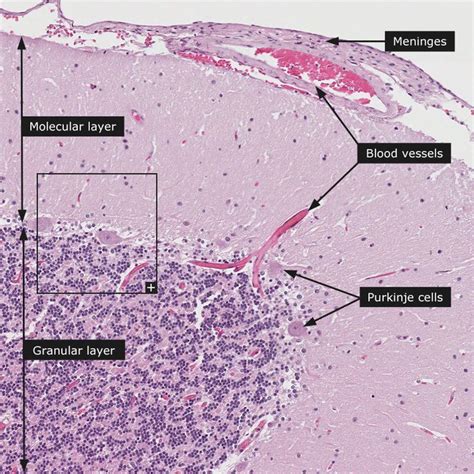 Dictionary - Normal: Cerebellum | Medical school studying, Medicine notes, Human anatomy and ...