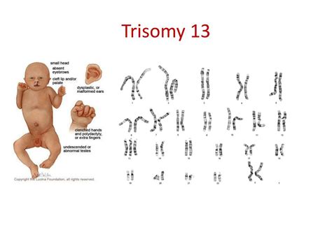 PPT - Genetics in Medicine PowerPoint Presentation, free download - ID ...