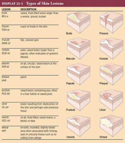 Skin Lesions Chart | Medical Terminology