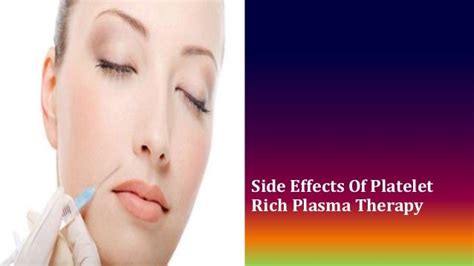 Side effects of platelet rich plasma therapy