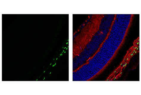 Myelin Protein Zero Antibody | Cell Signaling Technology