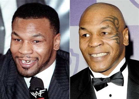 Mike Tyson and his transformation... || Team Demas Orthodontics - 51 ...