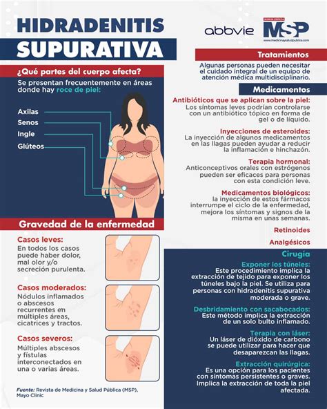 Hidradenitis Supurativa - Infografía