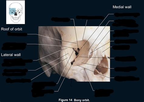 Bony Orbit Diagram | Quizlet