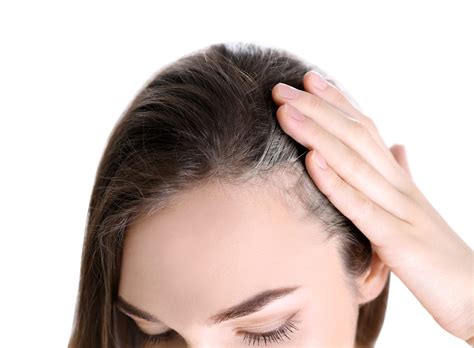 Female Hair Loss at The Temples: Causes and Treatment - Blog | Keranique