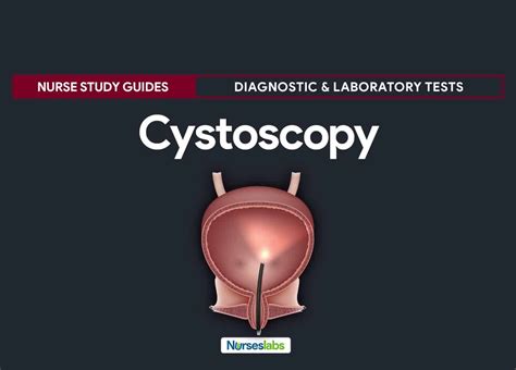 Cystoscopy | Nursing notes, Nursing study guide, Nursing students