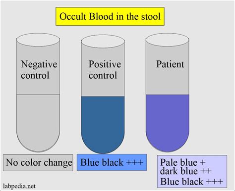 How To Check For Blood In Stool - Memberfeeling16