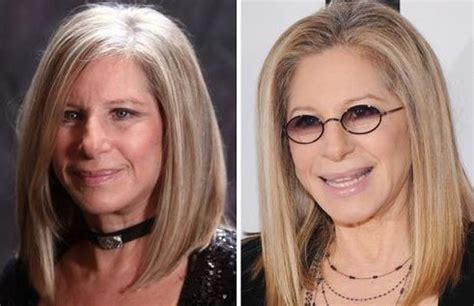 Barbra Streisand before and after plastic surgery (25) – Celebrity ...