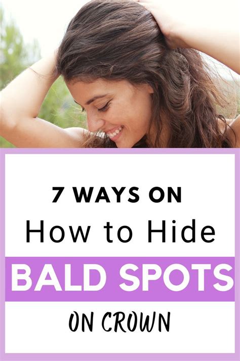 As someone who has bald spots on crown, here are some of the best tips ...