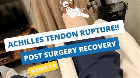 Achilles Tendon Rupture Recovery Weeks 1-3 -- Minimally Invasive Surgery, Tips & Recovery ...