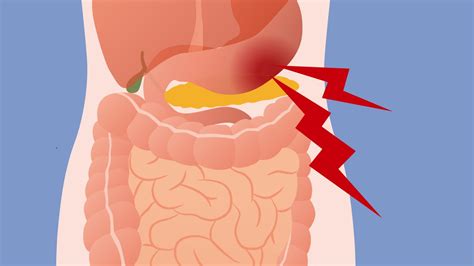 Stomach Ache Diagram