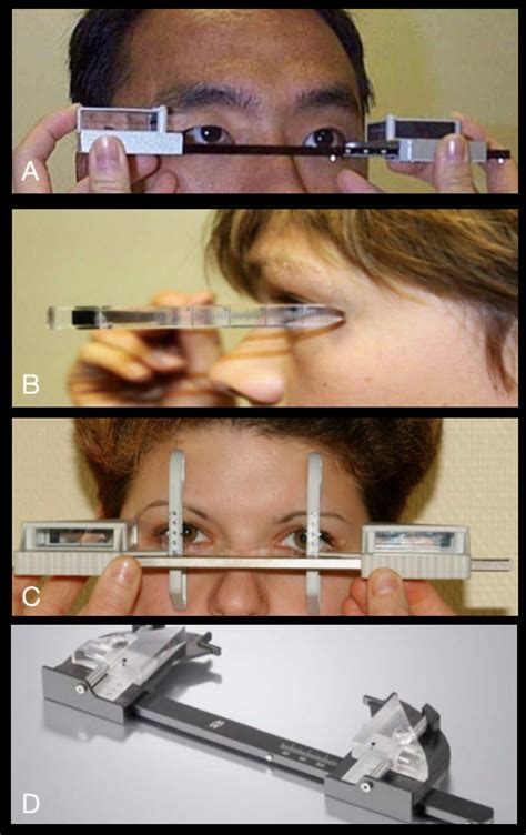 [Figure, Enophthalmos: the different types of...] - StatPearls - NCBI ...