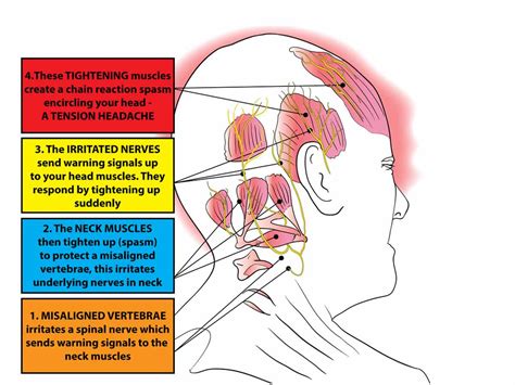 Headaches: Types, Causes and Treatment