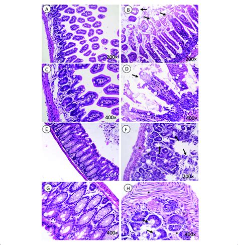 | Intestine histology. Necrosis is observed in intestinal microvilli ...