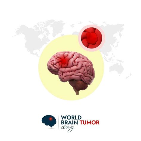 World Brain Tumor Day Design for Spread Awareness and Educate People About Brain Tumors 24720418 ...