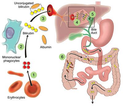 Evaluating Liver Test Abnormalities: Bilirubin Metabolism