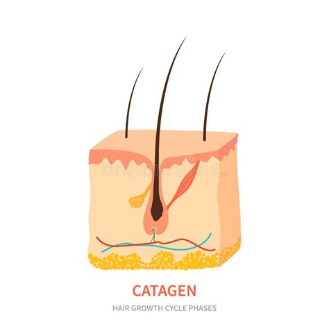 Catagen Hair Growth Phase in a Skin Cross Section Stock Vector - Illustration of removal, bald ...