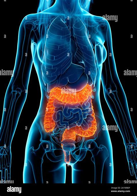 Diseased colon, computer illustration Stock Photo - Alamy