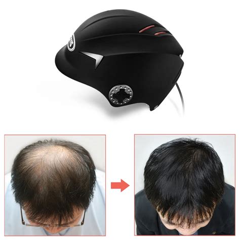 Men Hair growth Cap helmet Laser Hair regrowth laser helmet 64/128 Hair loss laser treatment ...