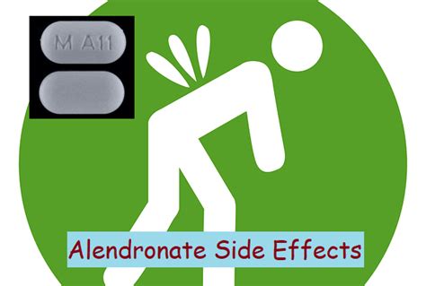 15 Alendronate Side Effects, Usage, And How To Use It » 2022