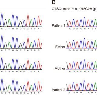 Genetic analysis revealed compound heterozygous mutations including two... | Download Scientific ...