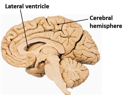 Lateral Ventricle - Anatomy QA