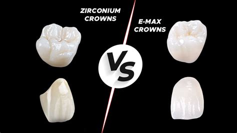 Zirconia Crown vs Emax Crown: Which is The Best Option?