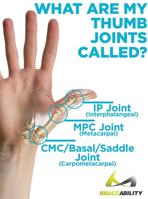 Pin on Thumb Pain Relief | Treatments & Splints for Basal Joint Fractures, Tendonitis, Sprains ...