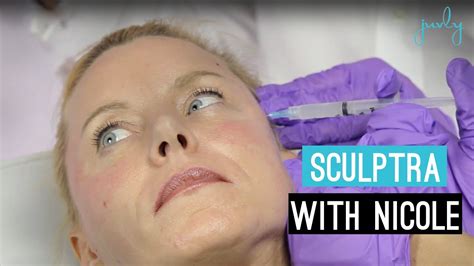 Procedure of Sculptra treatment with Cheek Fillers and Liquid Facelift ...