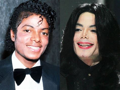 Image result for michael jackson plastic surgery