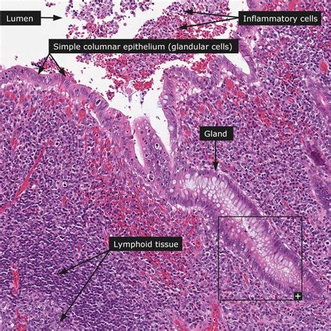 Dictionary - Normal: Appendix | Appendix, Glandular cells, Histology slides